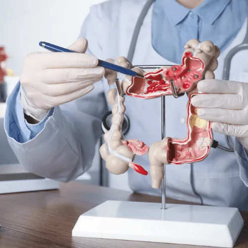 ¿Cómo tratar la gastritis de forma efectiva en Puerto Vallarta?