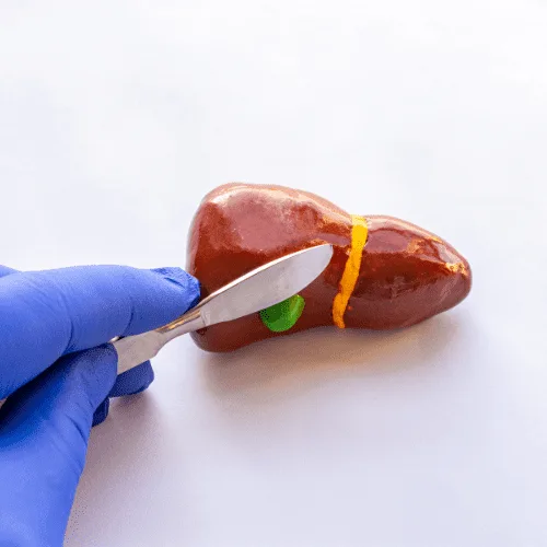 ¿Cómo detectar y tratar la hepatitis en Puerto Vallarta?