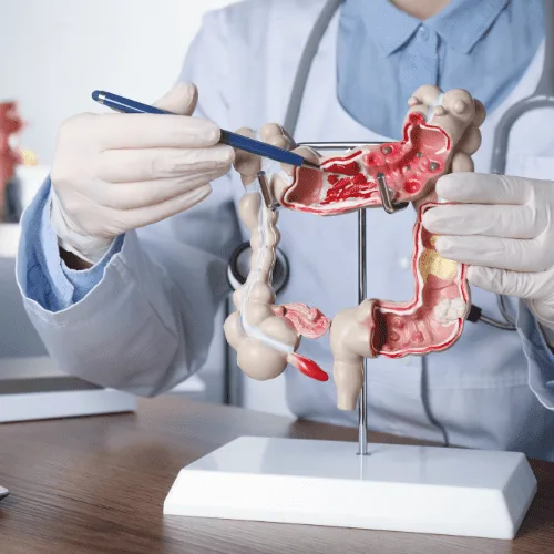 ¿Qué especialista trata la inflamación intestinal?